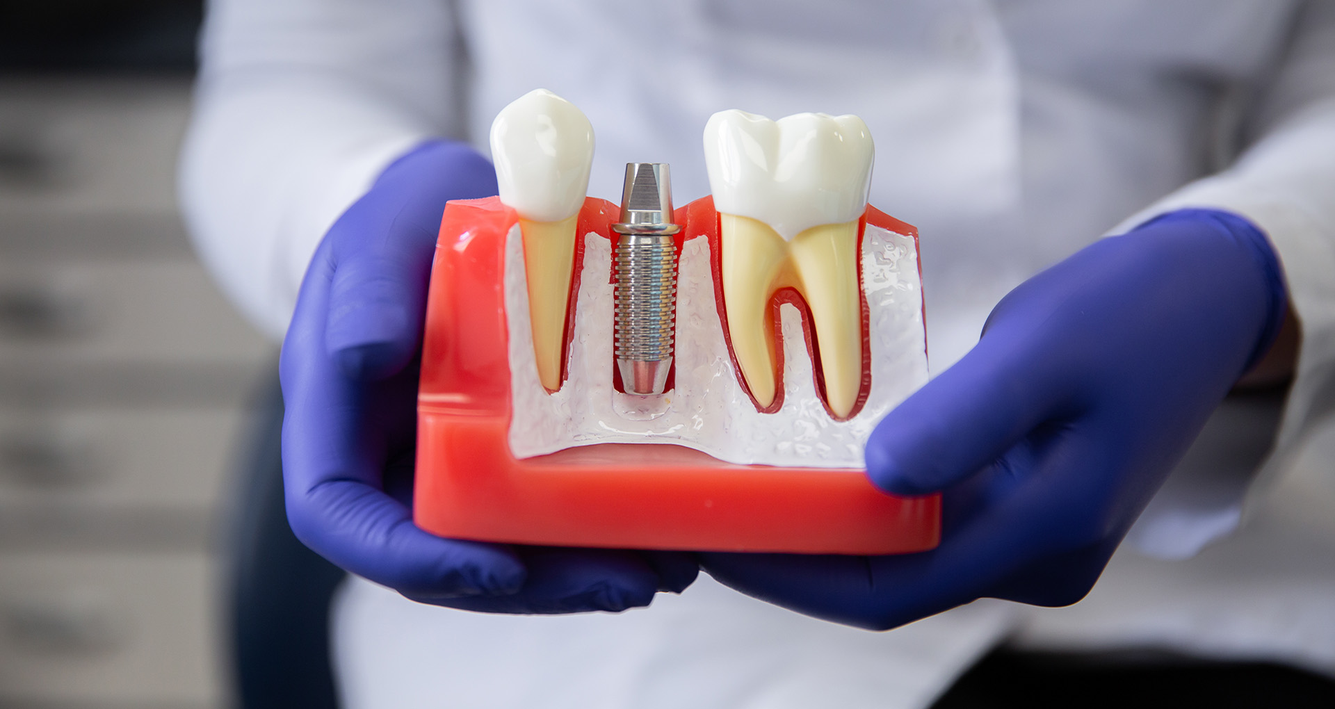 Dental Implants - Dental Implants In One Day and One Office | Natick, MA